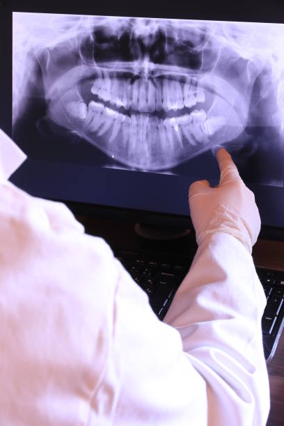 Best Knocked-Out Tooth (Avulsed Tooth) Treatment in Williamstown, WV